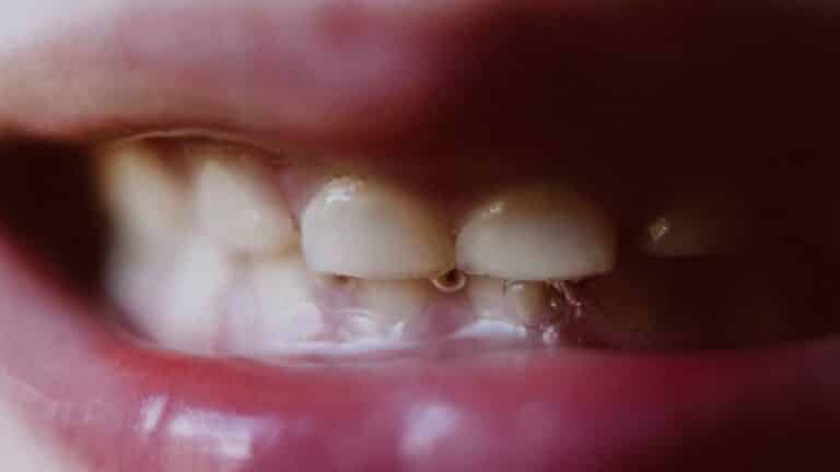 saliva