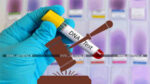 DNA Test